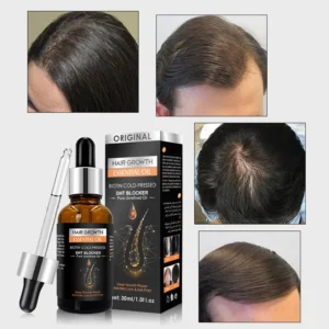 FATAZEN Scalp and Hair Care Essential Oil