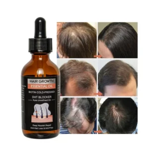 FATAZEN Scalp Care Hair Oil Serum